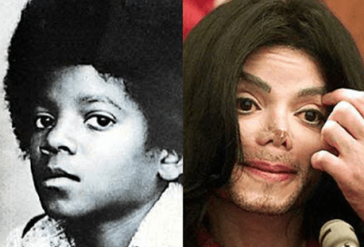 cosmetic surgery Michael Jackson