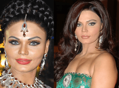 cosmetic surgery 2 Top 10 Bollywood and Hollywood Plastic Surgery Disasters