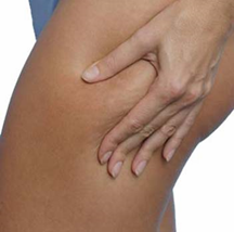 cellulite+treatment+home How to Treat Cellulite at Home