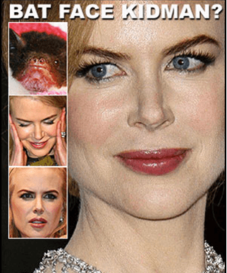 Nicole Kidman after the the brow lift surgery.