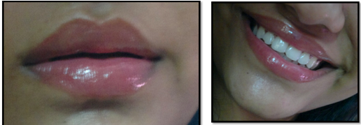 Vaseline Lip Care Rosy glow on lips