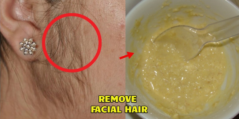 Top 5 Facial Hair Removal Methods