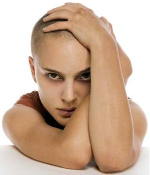 baldness in women