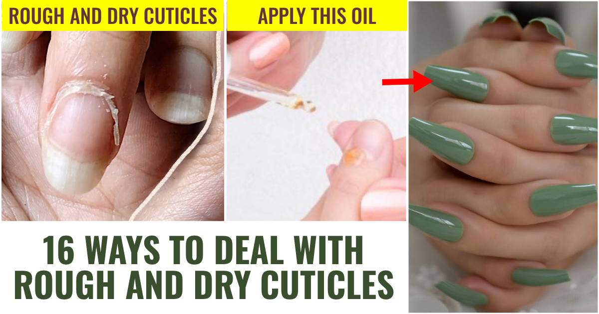 16 Ways to Deal with Cuticle Problems 