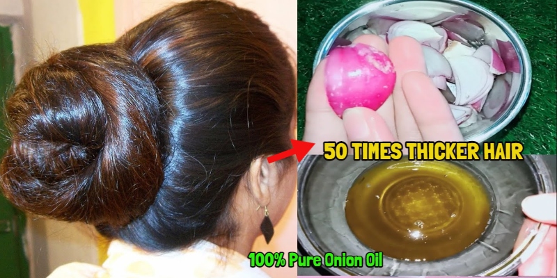 5 Onion Hair Packs to Control Hair Fall 