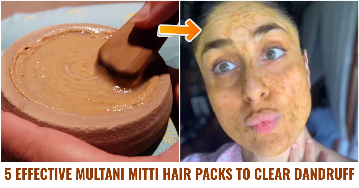 Sandalwood Powder And Multani Mitti Face Pack For Oily Skin DIY