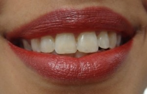 sparkling teeth