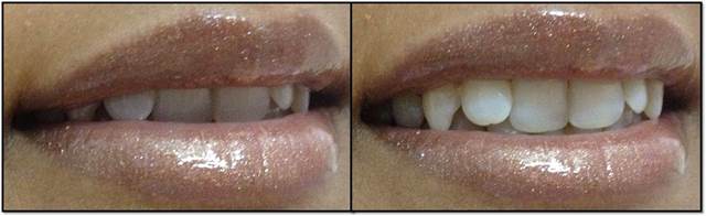 Shimmer lip gloss