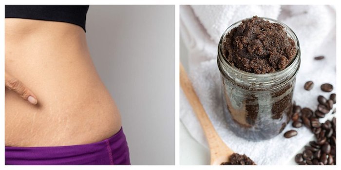 coffee for cellulite