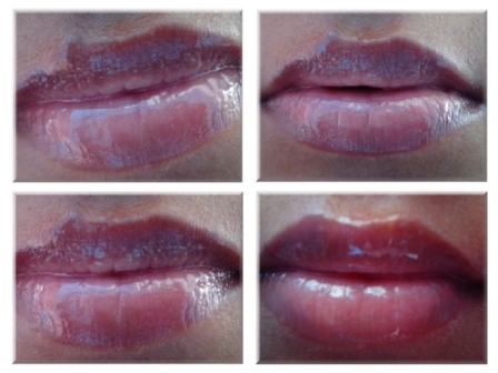glossy lips (1)