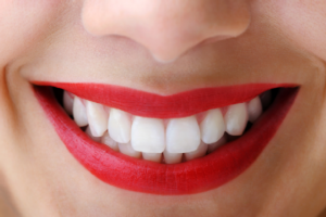 Teeth_Whitening___Causes_and_Cures_for_Yellow_Teeth_13