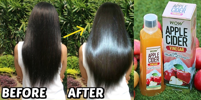 8 Ways to use Apple Cider Vinegar for Hair and Skin