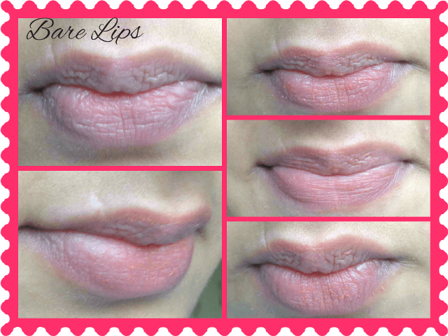 VLCC Lovable Lips Strawberry Lip Balm 6