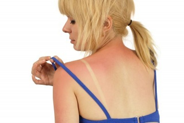 All You Wanted To Know About Sunscreens 5