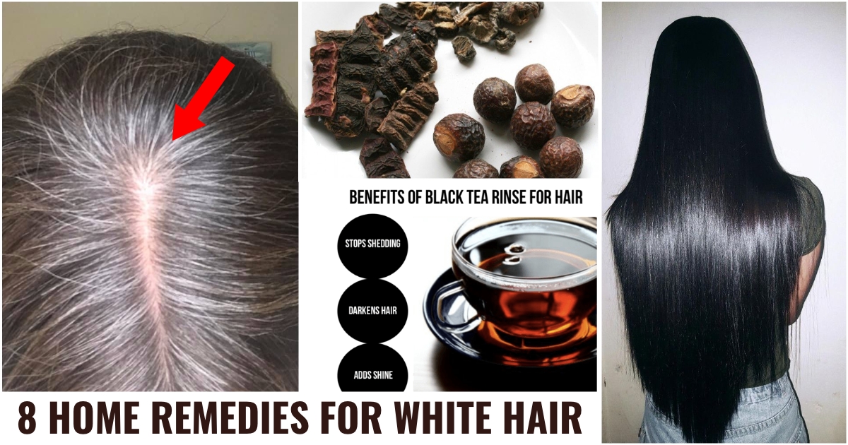 12 Home Remedies For Dry Hair | White To Black Hair Serum White To Black  Hair Moisturizing Conditioner Hair Oil For Fast Hair Growth Mask 