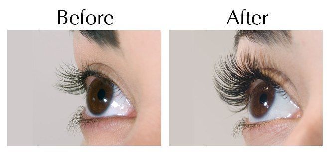Cosmetic Procedures for Eyelashes