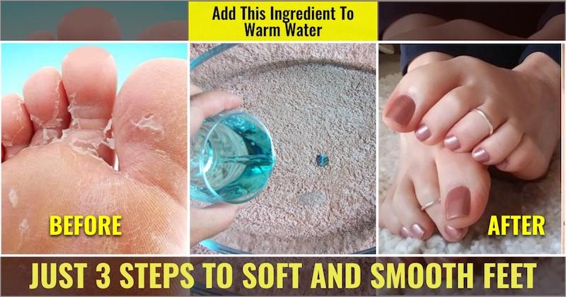 Steps to smooth feet