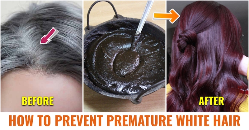 Complete Guide To Pre-Mature Greying Of Hair