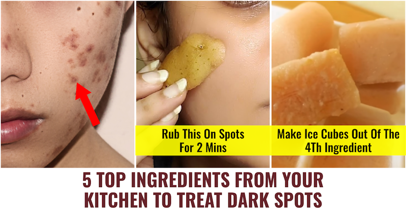 Dark spots treatment kitchen