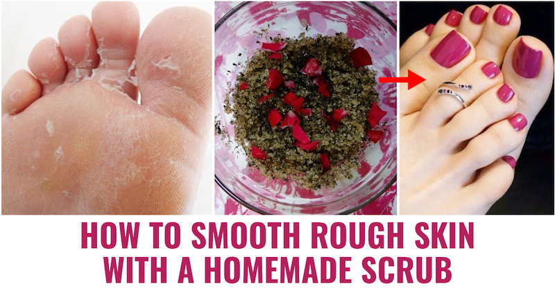 How To Smooth Rough Skin With A Homemade Scrub