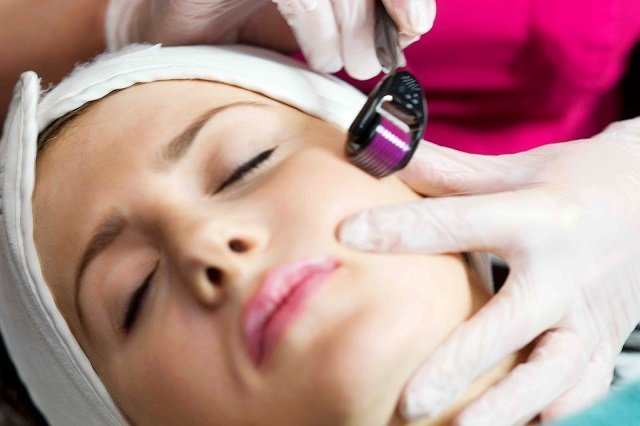 All You Need to Know About Skin Needling 