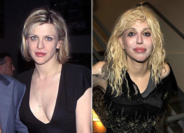 Beautiful Celebrities Who Ruined Their Looks Due To Drugs 2