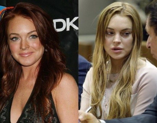 Beautiful Celebrities Who Ruined Their Looks Due To Drugs