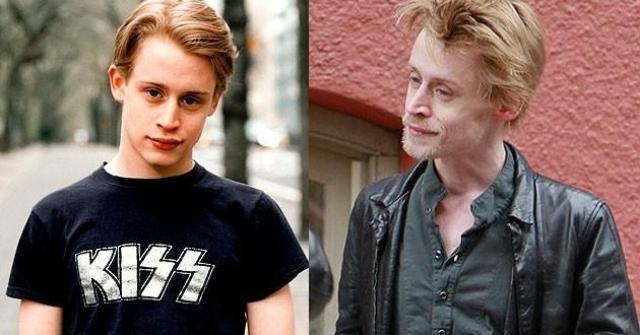 Beautiful Celebrities Who Ruined Their Looks Due To Drugs 5