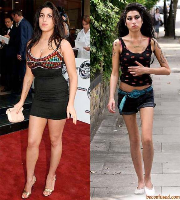 Beautiful Celebrities Who Ruined Their Looks Due To Drugs 7