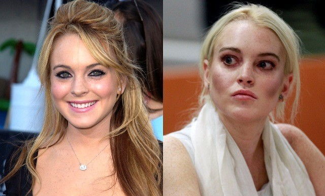 Beautiful Celebrities Who Ruined Their Looks Due To Drugs