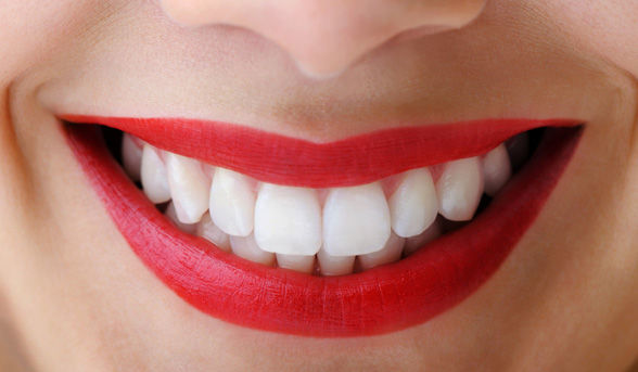 http://www.puresmile.com.au/wp-content/uploads/2015/04/white-teeth-and-red-lipstick.jpg