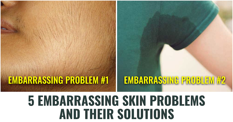 Embarassing Skin Problems