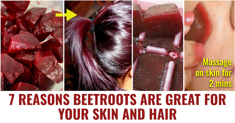 Beetroots are great for skin and hair