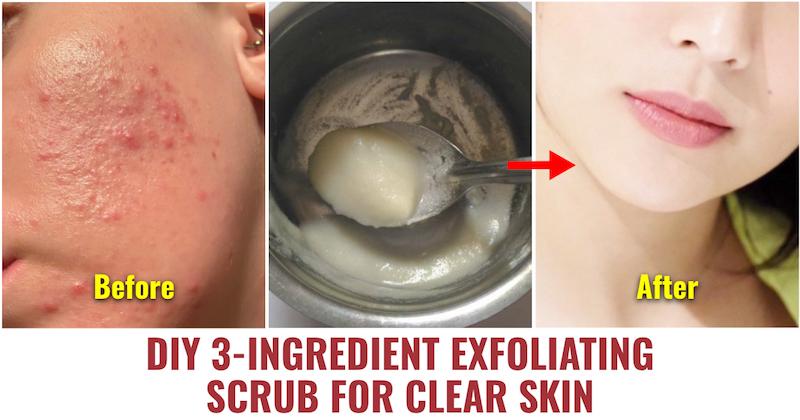 Exfoliating Scrub For Clear Skin