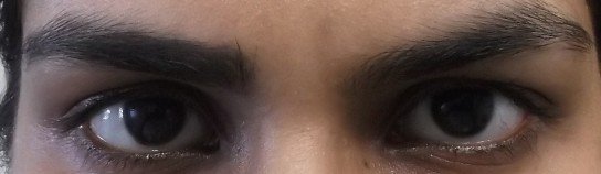 Left eyebrow with and right without