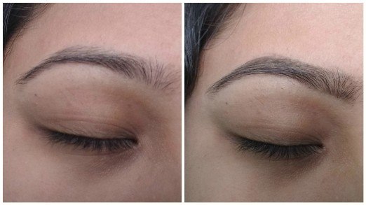 eyebrow before after