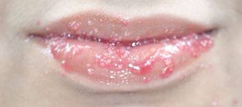 DIY Lip Scrub on Lips
