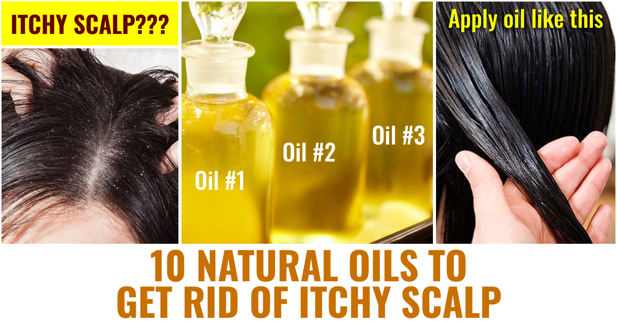 9 Natural Oils to Get Rid of Itchy Scalp