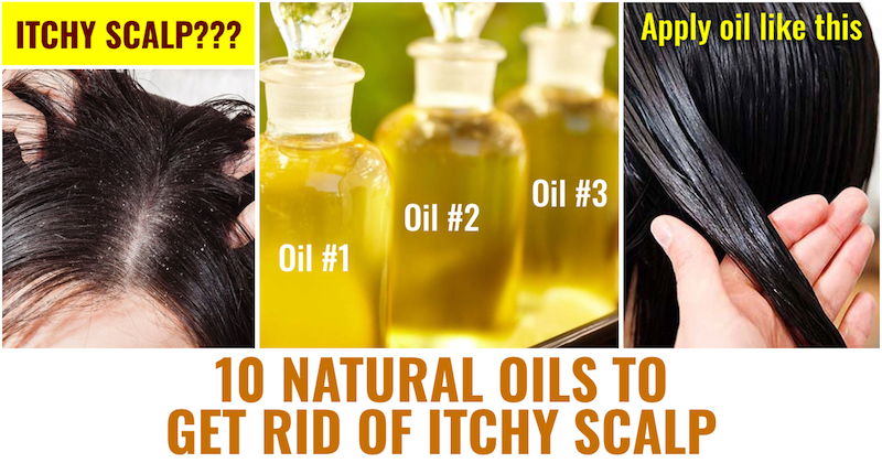 Natural Oils to get rid of itchy scalp