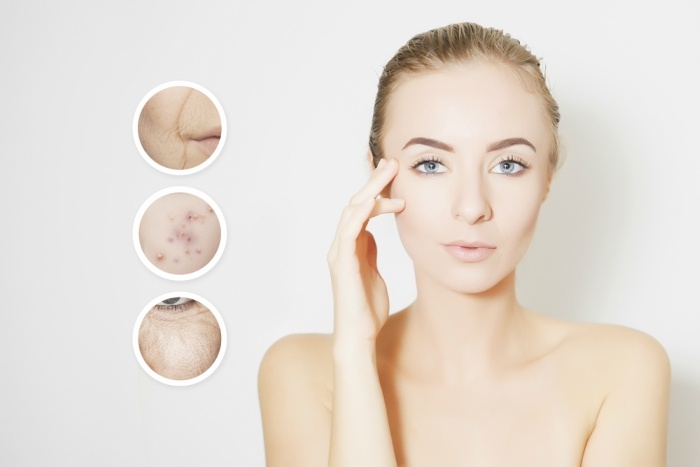 6-everyday-habits-that-lead-to-clogged-pores7