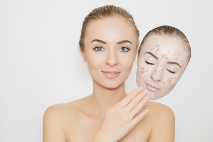 7 Benefits of Volcanic Ash Clay for the Skin1