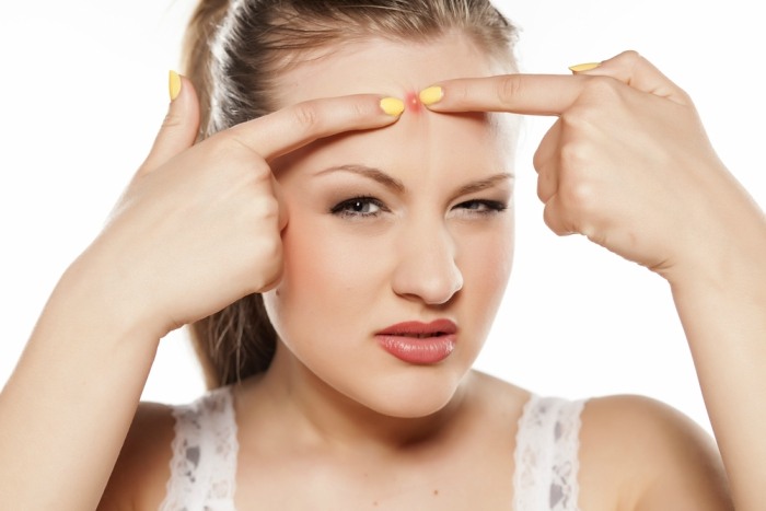 8 Common Mistakes You are Committing While Concealing a Pimple1