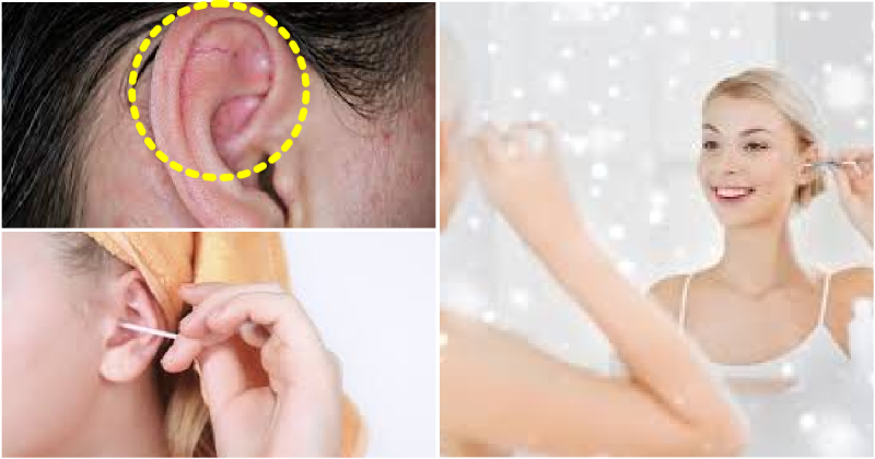 Amazing Remedies to Treat the Pimples Inside Your Ear 