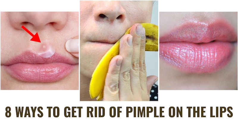 Pimple on the lips