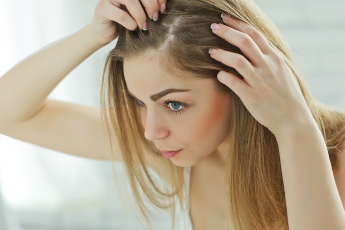 8 Side Effects of Hair Colouring Treatments Every Woman Should Know3