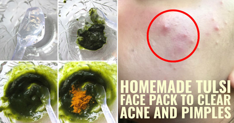 Homemade tulsi face pack