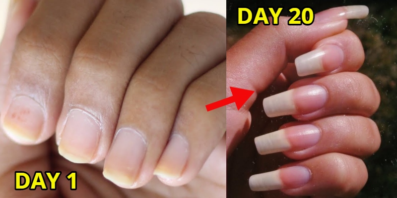 9 Surprising Habits that Could be Ruining Your Pretty Nails