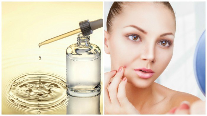 7 Skin Care Ingredients that Cause Acne Breakouts collage