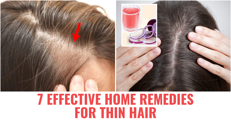 7 Effective Home Remedies for Thin Hair 