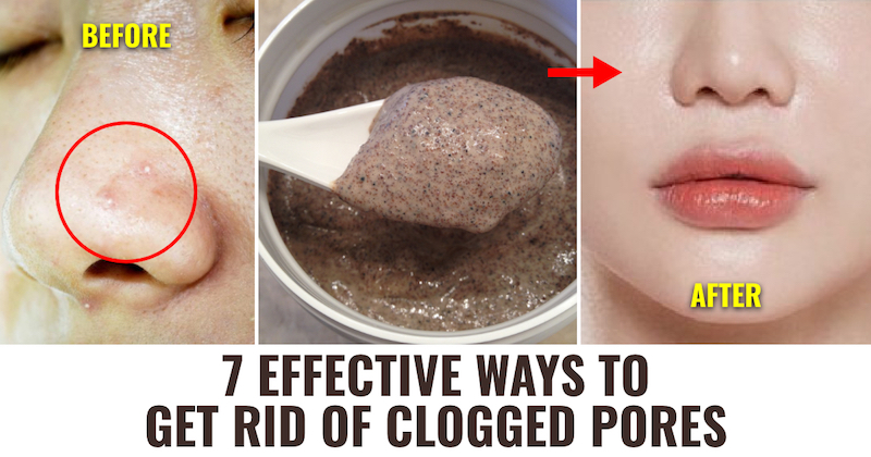Treat Clogged Pores